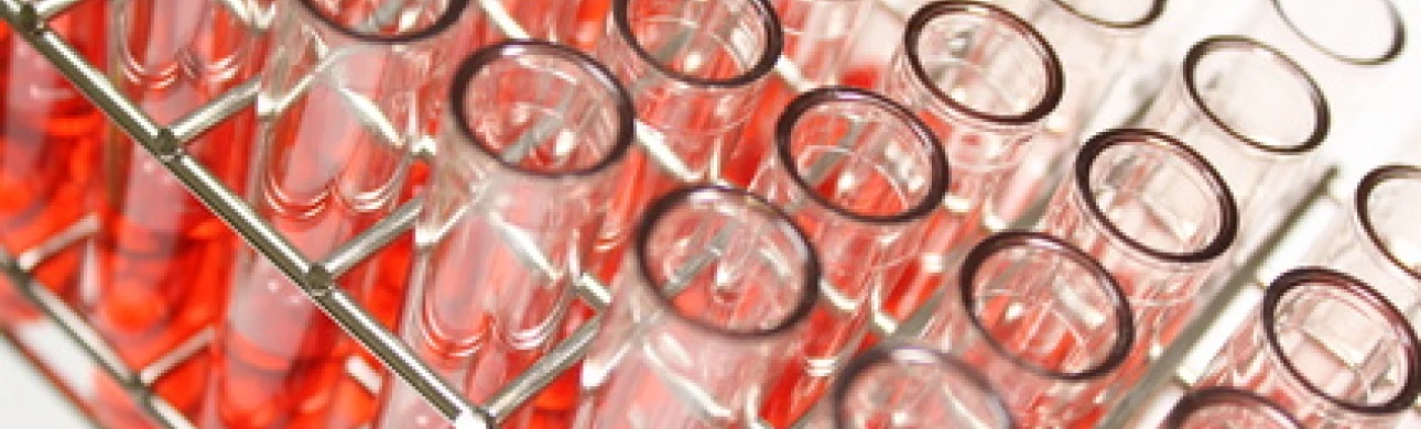 Jak sublingvální specifická alergenová imunoterapie mění koncentraci specifických IgE protilátek proti pylovým alergenům