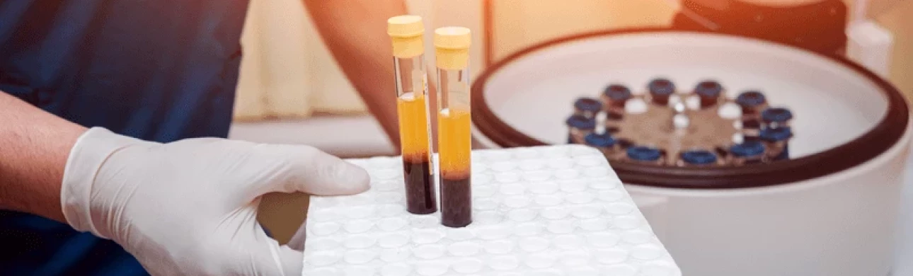 Nová platforma zdůrazňuje zásadní roli léčiv z plazmových proteinů