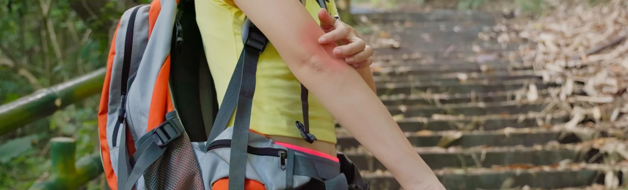 Nenechme si pokazit cestovatelské zážitky alergiemi