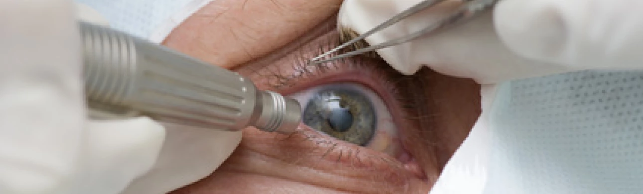 Laser v léčbě zeleného zákalu: šetrně a bezpečně