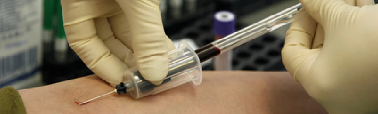 Znáte hodnoty svého cholesterolu? A víte, co pro vás tato čísla znamenají?